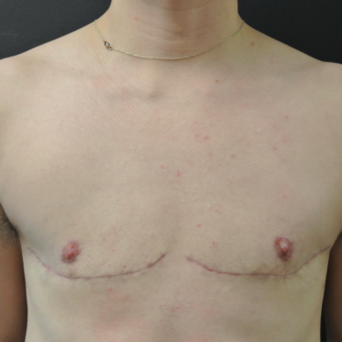 After Image