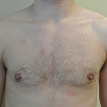 After Image