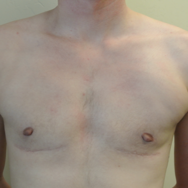 After Image