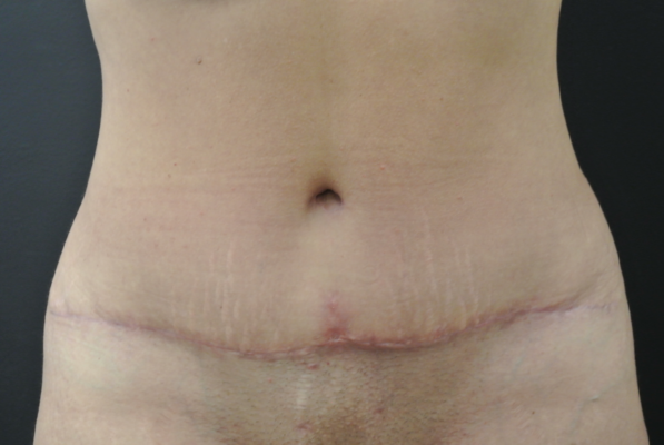 After Image