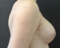 After Image