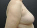 After Image