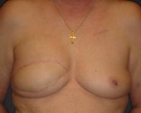 After Image