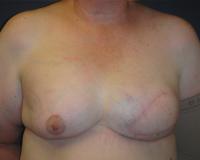 After Image