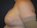 After Image