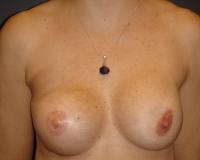 After Image