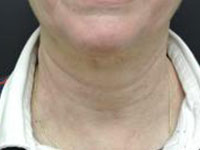 After Image