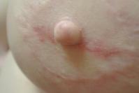 After Image